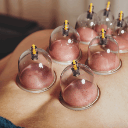 Cupping Paris Olympics Cupping Paris Olympics