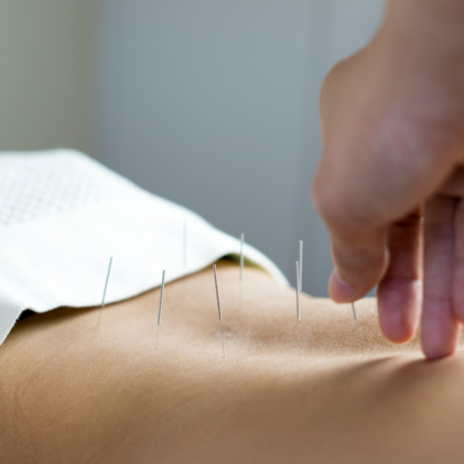Acupuncturist brookvale back pain Northern Beaches