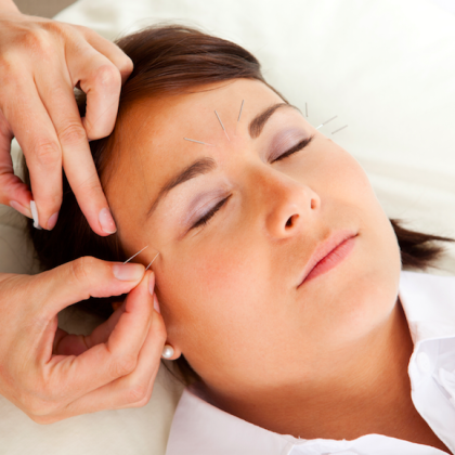 Cosmetic Acupuncture Sydney