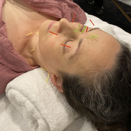 {{brizy_dc_image_alt entityId=