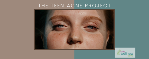 Teen Acne Project